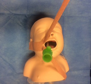 Securing An Endotracheal Tube Paediatric Emergencies